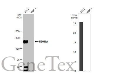 Anti-KDM6A antibody [N2C1], Internal used in Western Blot (WB). GTX121246