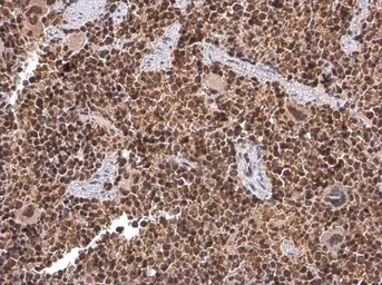 Anti-KDM6A antibody [N2C1], Internal used in IHC (Paraffin sections) (IHC-P). GTX121246