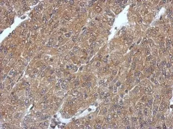 Anti-PHYHIP antibody used in IHC (Paraffin sections) (IHC-P). GTX121276