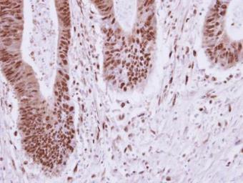 Anti-ELP2 antibody [N3C2], Internal used in IHC (Paraffin sections) (IHC-P). GTX121449