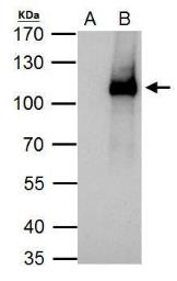 Anti-ELP2 antibody [N3C2], Internal used in Immunoprecipitation (IP). GTX121449