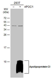 Anti-Apolipoprotein CI antibody used in Western Blot (WB). GTX121456