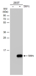 Anti-TFF1 antibody used in Western Blot (WB). GTX121461