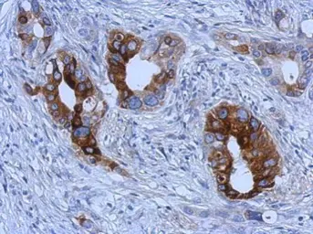 Anti-TFF1 antibody used in IHC (Paraffin sections) (IHC-P). GTX121461