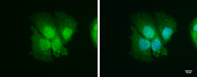 Anti-ISG15 antibody used in Immunocytochemistry/ Immunofluorescence (ICC/IF). GTX121474