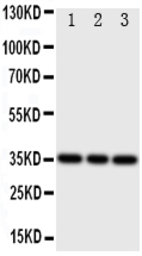 Anti-Bone Sialoprotein antibody used in Western Blot (WB). GTX12155