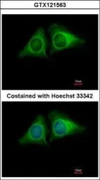 Anti-RASA4 antibody used in Immunocytochemistry/ Immunofluorescence (ICC/IF). GTX121563