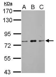 Anti-ZBTB20 antibody used in Western Blot (WB). GTX121616