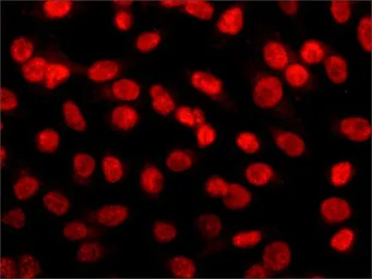 Anti-HDAC2 antibody [HDAC2-62] used in Immunocytochemistry/ Immunofluorescence (ICC/IF). GTX12169