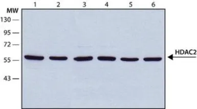 Anti-HDAC2 antibody [HDAC2-62] used in Western Blot (WB). GTX12169