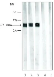 Anti-Histone H3K9me1 (Mono-methyl Lys9) antibody used in Western Blot (WB). GTX12177