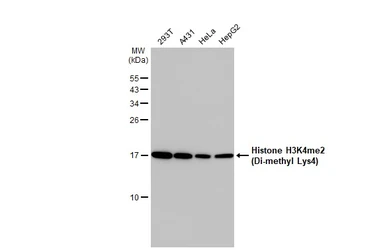 Anti-Histone H3K4me2 (Di-methyl Lys4) antibody used in Western Blot (WB). GTX121915