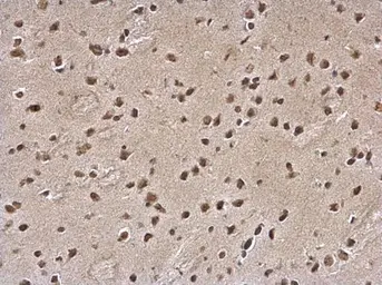 Anti-SLUG antibody used in IHC (Paraffin sections) (IHC-P). GTX121924