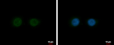 Anti-Nesprin 2 antibody [C3], C-term used in Immunocytochemistry/ Immunofluorescence (ICC/IF). GTX121928