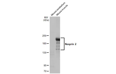 Anti-Nesprin 2 antibody [C3], C-term used in Western Blot (WB). GTX121928