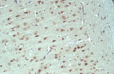 Anti-Nesprin 2 antibody [C3], C-term used in IHC (Paraffin sections) (IHC-P). GTX121928