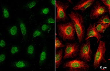Anti-Nesprin 2 antibody [C3], C-term used in Immunocytochemistry/ Immunofluorescence (ICC/IF). GTX121928
