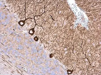 Anti-NME4 antibody used in IHC (Paraffin sections) (IHC-P). GTX121931