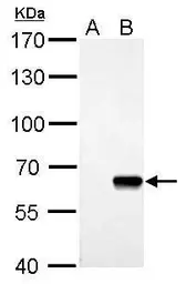 Anti-AKT antibody [N2C2], Internal used in Western Blot (WB). GTX121936