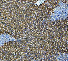 Anti-CYP2E1 antibody used in IHC (Paraffin sections) (IHC-P). GTX12194