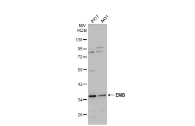 Anti-EMB antibody [N3C3] used in Western Blot (WB). GTX121952