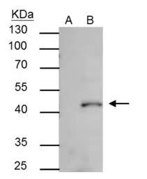Anti-SMYD3 antibody used in Immunoprecipitation (IP). GTX121956