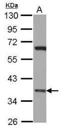 Anti-LHX8 antibody [N1C2] used in Western Blot (WB). GTX121974
