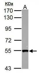 Anti-SMYD1 antibody used in Western Blot (WB). GTX122067