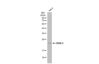 Anti-DERL3 antibody [N3C2], Internal used in Western Blot (WB). GTX122163