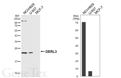 Anti-DERL3 antibody [N3C2], Internal used in Western Blot (WB). GTX122163