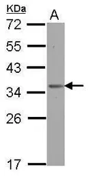 Anti-OTUD6B antibody used in Western Blot (WB). GTX122242