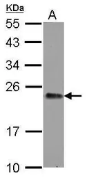 Anti-GNPNAT1 antibody [N1C3] used in Western Blot (WB). GTX122246