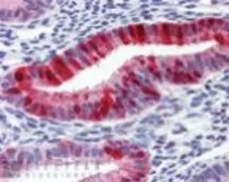 Anti-Metallothionein antibody [UC1MT] used in  (). GTX12228
