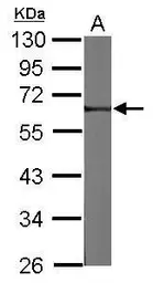 Anti-FRMD8 antibody [N3C3] used in Western Blot (WB). GTX122394