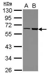 Anti-FRMD8 antibody [N3C3] used in Western Blot (WB). GTX122394
