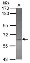 Anti-ACOT12 antibody [C1C3] used in Western Blot (WB). GTX122449