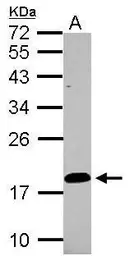 Anti-Lipocalin 15 antibody used in Western Blot (WB). GTX122512