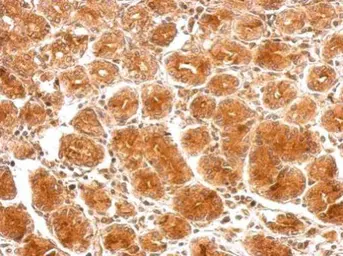 Anti-SAMD4B antibody used in IHC (Paraffin sections) (IHC-P). GTX122549