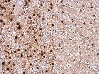 Anti-ROCK2 (phospho Ser1366) antibody used in IHC (Paraffin sections) (IHC-P). GTX122651