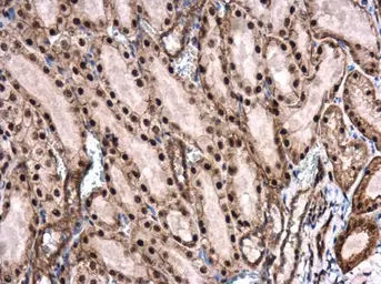 Anti-ROCK2 (phospho Ser1366) antibody used in IHC (Paraffin sections) (IHC-P). GTX122651