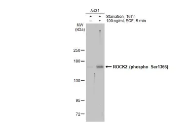 Anti-ROCK2 (phospho Ser1366) antibody used in Western Blot (WB). GTX122651