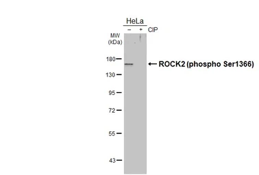 Anti-ROCK2 (phospho Ser1366) antibody used in Western Blot (WB). GTX122651