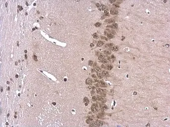 Anti-ROCK2 antibody used in IHC (Paraffin sections) (IHC-P). GTX122652