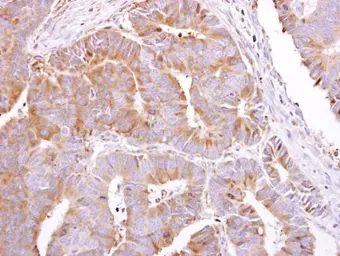 Anti-PEPP2 antibody [N1N2], N-term used in IHC (Paraffin sections) (IHC-P). GTX122690