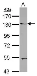 Anti-PEPP2 antibody [N1N2], N-term used in Western Blot (WB). GTX122690