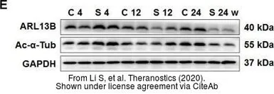 Anti-ARL13B antibody used in Western Blot (WB). GTX122703