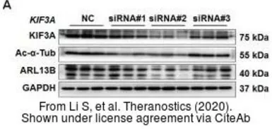 Anti-ARL13B antibody used in Western Blot (WB). GTX122703