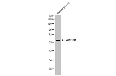 Anti-ARL13B antibody used in Western Blot (WB). GTX122703