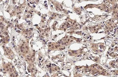 Anti-ARL13B antibody used in IHC (Paraffin sections) (IHC-P). GTX122703