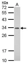 Anti-PROSC antibody used in Western Blot (WB). GTX122706